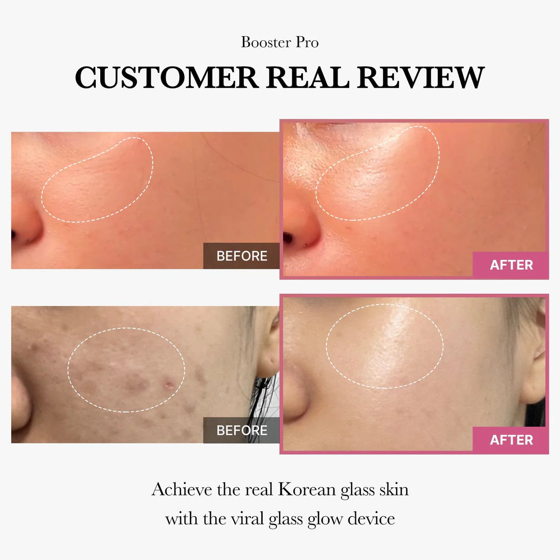 Medicube Age-R Booster Pro