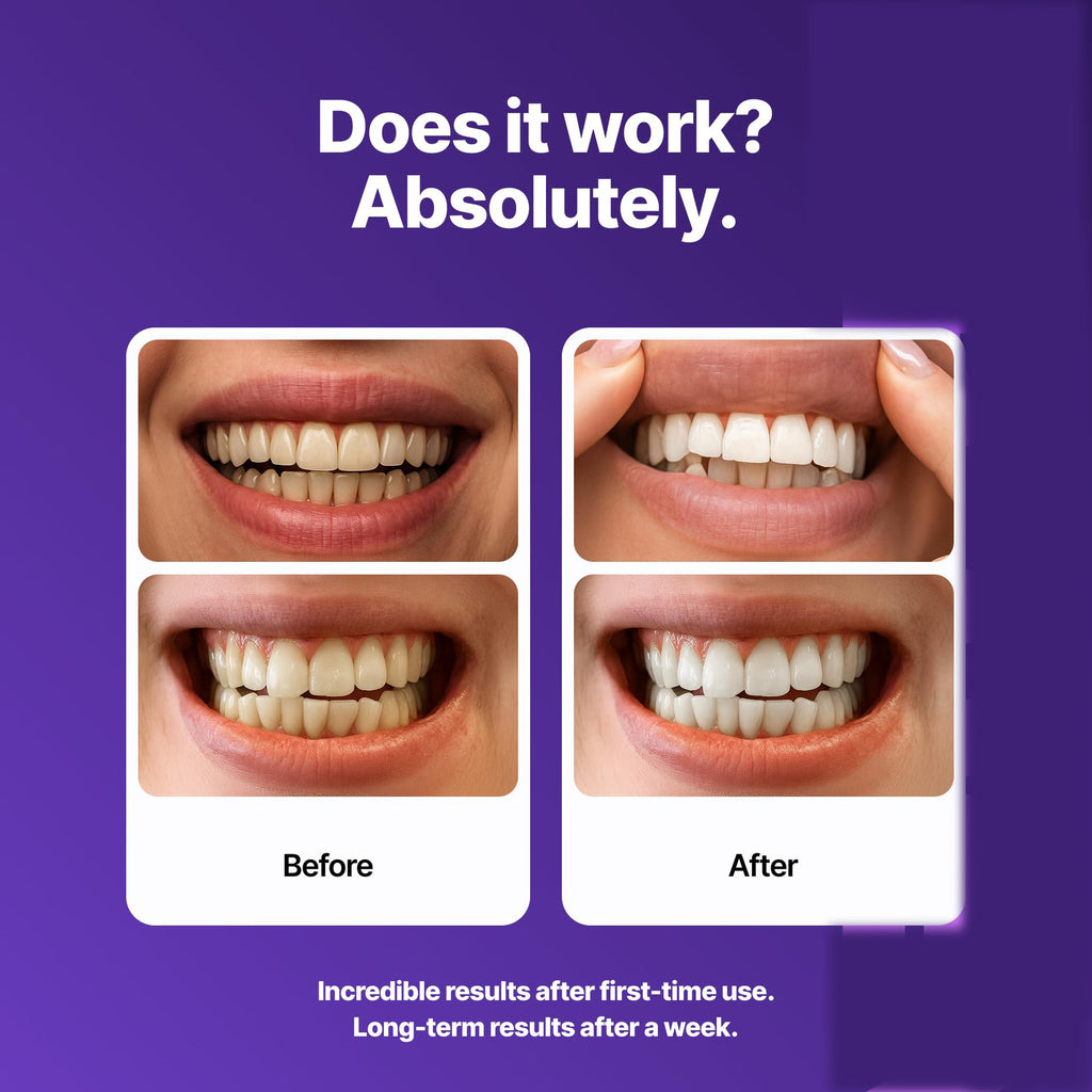 Dr.Dent Teeth Whitening Strips